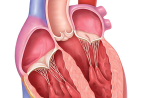 Trikuspidalklappeninsuffizienz: Welche Alternativen zur konventionellen Herz-OP gibt es?