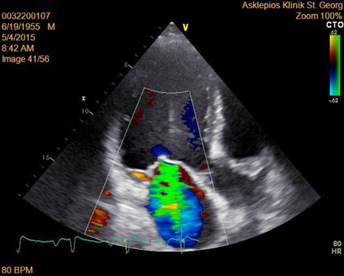 Echokardiographie – Das Herz sichtbar machen